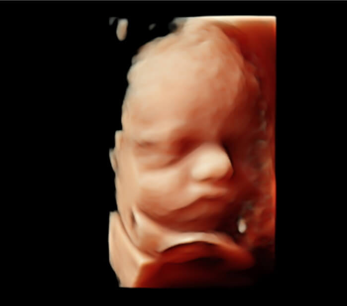 Ultrasound 4D Video Package