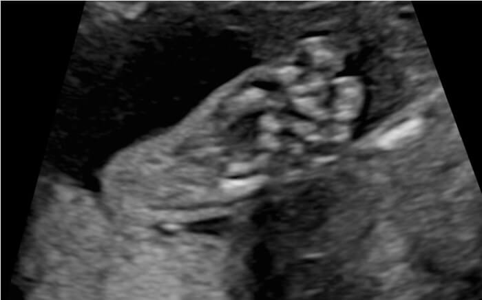 Ultrasound Wellbeing Scan